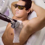 Depilación cuerpo promo hombres