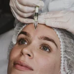 Plasma rico en plaquetas facial